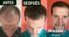 Foto de Eikona & Styl :. Cl�nica de restauraci�n capilar-tratamiento