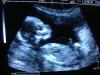 Foto de Ginecologo, colposcopia y ultrasonido